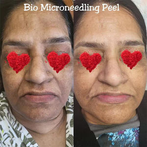 G สาหร่ายชุดบำรุงผิวสำหรับรักษาสิว<span class=keywords><strong>ฝ้า</strong></span>ทำให้ผิวขาวหน้ากากซิ<span class=keywords><strong>ล</strong></span>ิโคนแบบเข็ม - Product Image 5