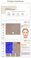 Detector de piel con pantalla integrada de 15,6 "Interfaz táctil para pruebas sencillas/completas adecuadas para uso en salones de belleza y spas