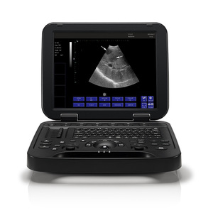 Dispositivo de Diagnóstico Digital Portátil de Ultrasonido Veterinario Promax PU-VDL151A para Uso Animal - Product Image 3