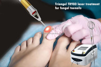 Laser à Diode 980nm, thérapie des ongles d'orteils, thérapie des champignons des ongles