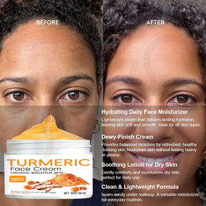 <span class=keywords><strong>Crème</strong></span> au curcuma de marque privée Pure Healing, nettoie la peau, combat l'<span class=keywords><strong>acné</strong></span>, unifie le teint, atténue les cicatrices, les dommages du soleil, <span class=keywords><strong>crème</strong></span> au curcuma <span class=keywords><strong>cicatrisante</strong></span> - Product Image 3