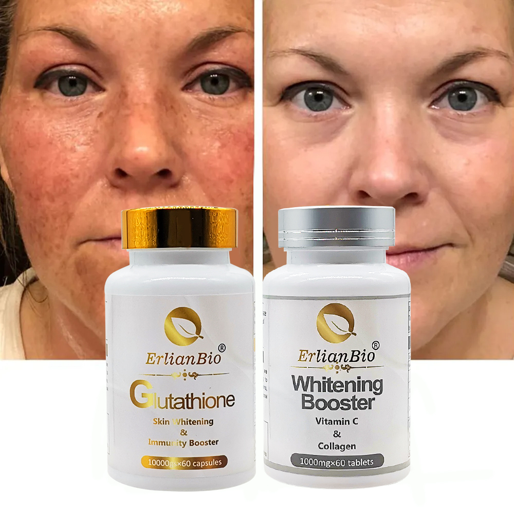 Natural Gluten-Free Whitening Kit with Vitamin C Collagen 60 Pcs Tablets  Capsules Combo Skin Glow Enhancement for Daily Use| Alibaba.com