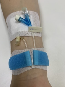 Disposable Medical IV Cannula <strong>Remaining</strong> <strong>Needle</strong> Fixation Transparent Dressing Catheter Fixation Kit Latex-Free CE Certified Class - Product Image 5