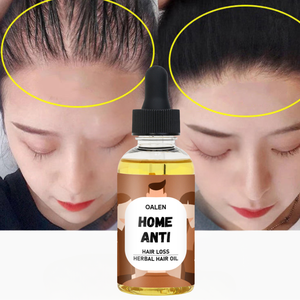 น้ำมันบำรุงเส้นผมสูตรสมุนไพรออร์แกนิค 30 มล. ผลิตภัณฑ์เพื่อการเจริญเติบโตของเส้นผม แบรนด์ส่วนตัว 100% จากธรรมชาติ สำหรับใช้ที่บ้าน ป้องกันผมร่วง - Product Image 1