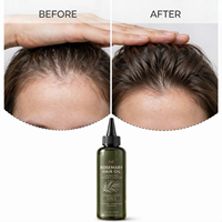 Minyak Pertumbuhan Rambut LANCE OEM Rosemary Menutrisi Secara Mendalam Menambah Kilau Campuran Botani Alami untuk Perawatan Rambut yang Lebih Sehat dan Kuat