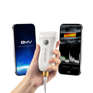 Giới thiệu các MX5 đi siêu âm xách tay mới nhất trong thú y thiết bị giám sát - Product Image 2
