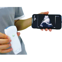 Échographe Doppler Couleur Sans Fil à Double Têtes Convexes et Linéaires 3-en-1 pour Usage Cardiaque