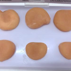 Modelo Anatómico de Tumor Prostático Humano para Ciencias Médicas, Modelo de Anatomía Humana - Product Image 5