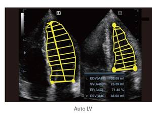 Mindray-sistema de ultrasonido para diagnóstico de DC-60, alta calidad, para uso hospitalario - Product Image 4