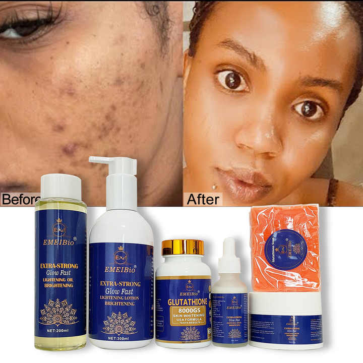OEM Whitening Skin Care Set Double-glutathione Oil Vitamin C Serum Dark  Spot Face Cream Black Skin Soap Bleaching Body Lotion