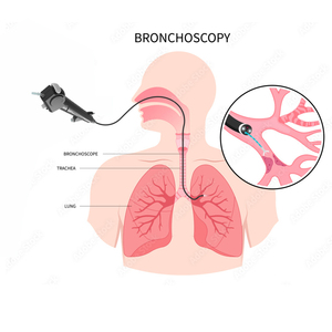 Endoscope flexible USB médical, vidéo-<span class=keywords><strong>bronchoscope</strong></span> pour usage vétérinaire chez le chien - Instruments chirurgicaux - Product Image 1