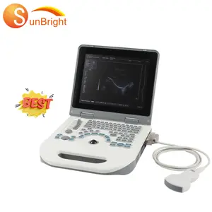 Full digital portable medical ultrasound scan machine baby pregnancy ultrasound hospital equipment