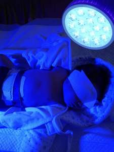 Lámpara de Fototerapia para Ictericia en Bebés Recién Nacidos, Portátil, con Luz Azul, Máquina para el Cuidado de la Piel, 18 Chips LED, para Todo Tipo de Piel, Bombillas Azules - Product Image 5