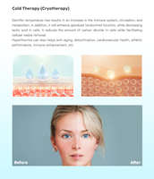 Appareil multifonctionnel de microdermabrasion à bulles, éliminateur de points noirs, jet d'oxygène, peeling facial, appareil de rajeunissement du visage
