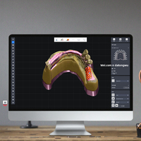 Software industriale digitale personalizzato per l'analisi della morfologia dei denti monitoraggio dell'usura apprendimento profondo AI piattaforme mobili/Desktop