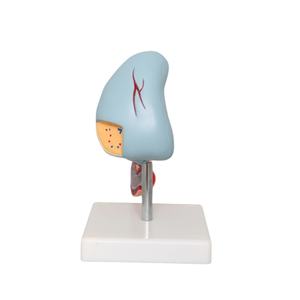 Anatomie Van Het Menselijk Lichaam Model Ziekten Van <span class=keywords><strong>Pancreas</strong></span> Milt Galblaas Anatomisch <span class=keywords><strong>Pancreas</strong></span> Model - Product Image 3