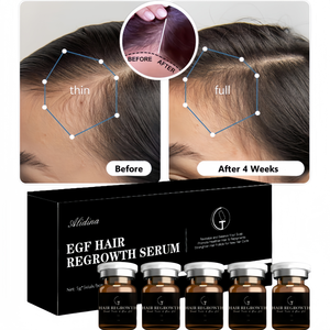 Booster de repousse des cheveux en T Restauration des cellules souches Soin du cuir chevelu Renforce les racines des cheveux Stimule la croissance et réduit la perte de cheveux Sérum - Product Image 2