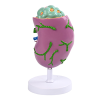 Modèle anatomique d'organe rénal agrandi avec ganglions lymphatiques - Outil de démonstration pédagogique du système lymphatique pour l'enseignement médical