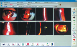 नेत्र अस्पताल के लिए नेत्र उपकरण 5 चरण आवर्धन एलईडी स्लिट लैंप डिजिटल स्लिट लैंप कैमरा - Product Image 6