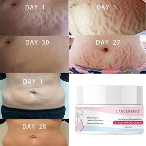 Crème anti-vergetures naturelle pour femmes enceintes, hydratant, vente en gros et personnalisation - Product Image 2