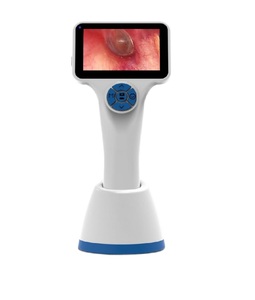 Otoscopio Veterinario con Pantalla Táctil LED de 3.2 Pulgadas, Video Otoscopio, Pantalla LCD de 3.2 Pulgadas para una Visión Clara - Product Image 1