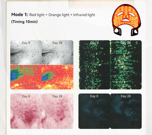 قناع وجه محمول من السيليكون للعلاج بالضوء الأحمر والأشعة تحت الحمراء بتقنية الفوتون للعناية بالبشرة - Product Image 4