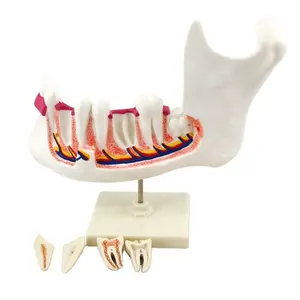 الجملة الطبية تكبير للإزالة التشريحية الإنسان الأسنان نموذج لشكل الأسنان