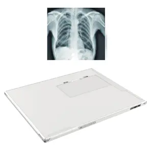 Hot Selling 17*17 Draadloze Dr X Ray Flat Panel Detector Voor X Ray Machine