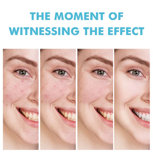 Gel Reparador Rápido y Efectivo para Cicatrices de Acné, Elimina Manchas, Suaviza la <span class=keywords><strong>Piel</strong></span>, Reduce los Poros, Crema Facial con Ácido Salicílico - Product Image 4