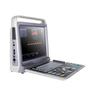 Sistem Diagnostik USG Doppler Warna <span class=keywords><strong>Digital</strong></span> Portabel Veteriner Profesional Derry Z70S Bersertifikasi ISO13485 - Product Image 2