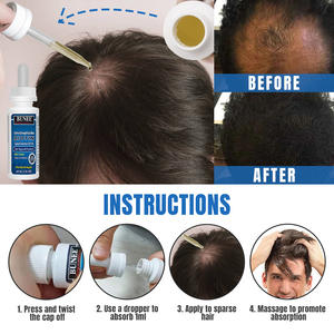 Orgánica biotina Etiqueta Privada milagro venta al por mayor hombre Herbal Romero Rerowth rápido OEM suero de aceite para el crecimiento del cabello para adultos - Product Image 3