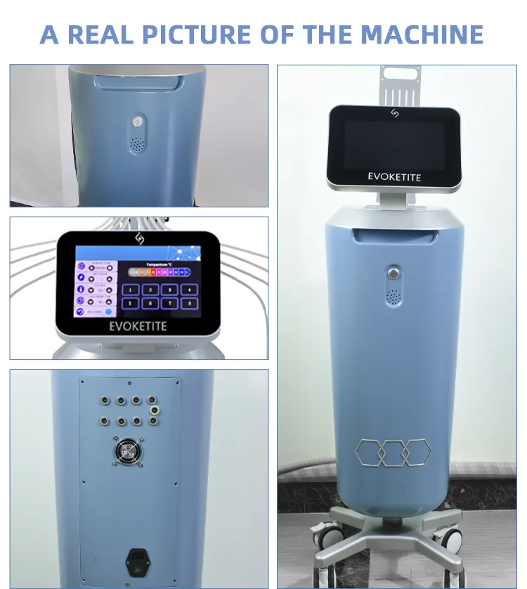 Trusculpt Flex RF1mhz BipolarRF機器肌の引き締めセルライト治療はタイトトラスカルトマシンを進化させます