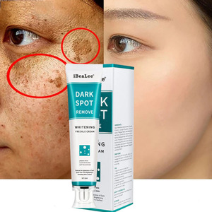 Creme Clareador de Manchas IBeaLee Remove <span class=keywords><strong>Melasma</strong></span> e Manchas Escuras Clareia a Melanina Hidratante Iluminador para Cuidados com a Pele do Rosto 20ml - Product Image 5