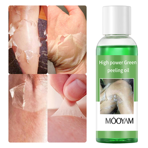Óleo de peeling verde OEM de alta potência para clareamento da pele, óleo de peeling para remoção de cicatrizes e estrias, marca própria, 100ml - Product Image 6