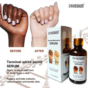 Suero de blanqueamiento rápido para nudillos oscuros al por mayor, correctores de pigmentación, codos de nudillos de mano, suero removedor de <span class=keywords><strong>manchas</strong></span> intensas de rodilla - Product Image 2