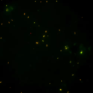 BestScope BS-2040FB(LED、TB) LEDイルミネーション蛍光生物顕微鏡 (子宮内視鏡検査用) - Product Image 6