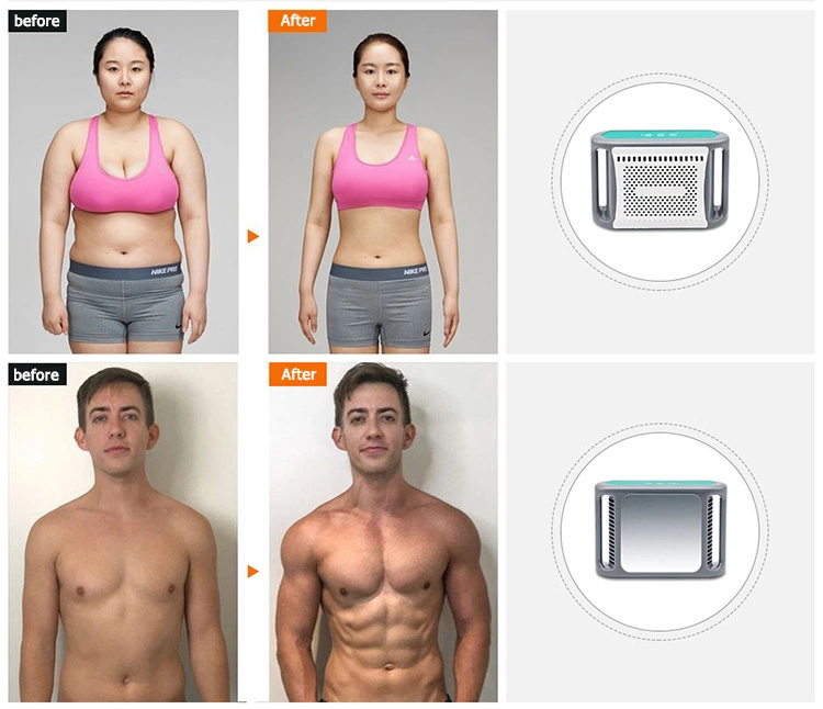 cryolipolysis slimming machine