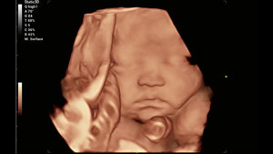 Ecógrafo Doppler Color 3D 4D Mindray Consona N6 con Smart Face y Smart OB para Evaluación Fetal - Product Image 5