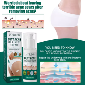Crema Orgánica de Vitamina E de Alta Calidad de 100 ml para el Cuidado de los Glúteos y Calmante para el Cuerpo, Reparación de la Piel y Combatencia del Acné - Product Image 5