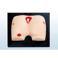 Modelo de simulación de úlceras por presión para el cuidado de heridas en glúteos, modelo de PVC para entrenamiento en el cuidado de heridas múltiples y médicas.