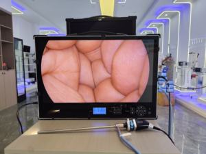 Système de caméra endoscopique portable tout-en-un, dispositifs médicaux professionnels, écran 4K avec moniteur et source lumineuse - Product Image 3