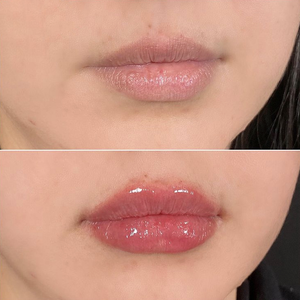 ลิปอินเจคชั่นแคปไซซินยอดนิยมแบบขายส่ง ให้ริมฝีปากอวบอิ่มเป็นพิเศษ พร้อมรับผลิตแบรนด์ส่วนตัว - Product Image 3