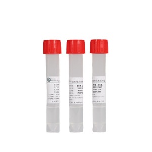 YIGUOREN Viral Sampling Tube PP Screw Cap Single Use For Detection <b>Transport</b> Storage - Product Image 5