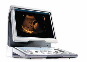 Mini máquina de ultrassom z60, ultrassom z5/z6 sistema de ultrassom - Product Image 2