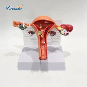 Modèles utérins normaux <span class=keywords><strong>et</strong></span> pathologiques, modè<span class=keywords><strong>le</strong></span> d'enseignement en sciences médicales, modèles anatomiques <span class=keywords><strong>et</strong></span> médicaux - Product Image 1