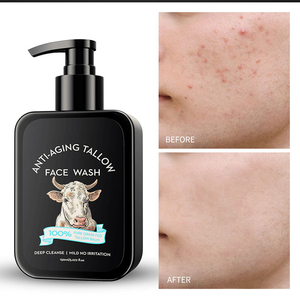 Productos Naturales <span class=keywords><strong>para</strong></span> el Cuidado Diario de la <span class=keywords><strong>Piel</strong></span> OEM ODM Personalizados, Kit Antienvejecimiento, Set de Cuidado de la <span class=keywords><strong>Piel</strong></span> <span class=keywords><strong>para</strong></span> Hombres, Humectante, Limpiador, Set de Cuidado de la <span class=keywords><strong>Piel</strong></span> - Product Image 4