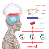 Casque de luminothérapie rouge pour l'amélioration du flux sanguin et de l'ATP cérébral, thérapie par lumière infrarouge proche 810 nm pour Parkinson