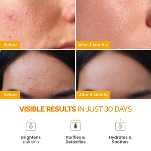 Maschera all'Argilla e Curcuma a Marchio Privato, Pulizia Profonda, Schiarente, Minimizzatore di Pori per Pelle Grassa - Product Image 5
