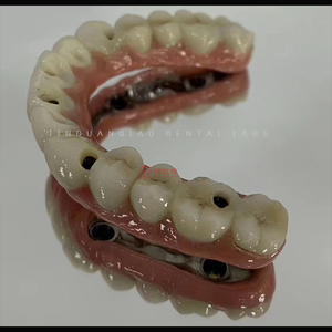 ทันตกรรมรากฟันเทียมทางคลินิกที่มีครอบฟันเซอร์โคเนียและกรอบไทเทเนียมครอบฟันพอร์ซเลนโคบอลต์และโครเมี่ยม - Product Image 5