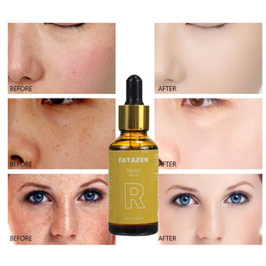 Private Label Remove Wrinkles Anti <strong>Aging</strong> Acne Retinol Serum 1% in Squalane <strong>Vitamin</strong> C Hyaluronic Acid Beauty Skin Care Face Serum - Product Image 2